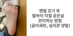 썸네일 맨발 걷기 후 발바닥 각질 굳은살 관리하는 방법